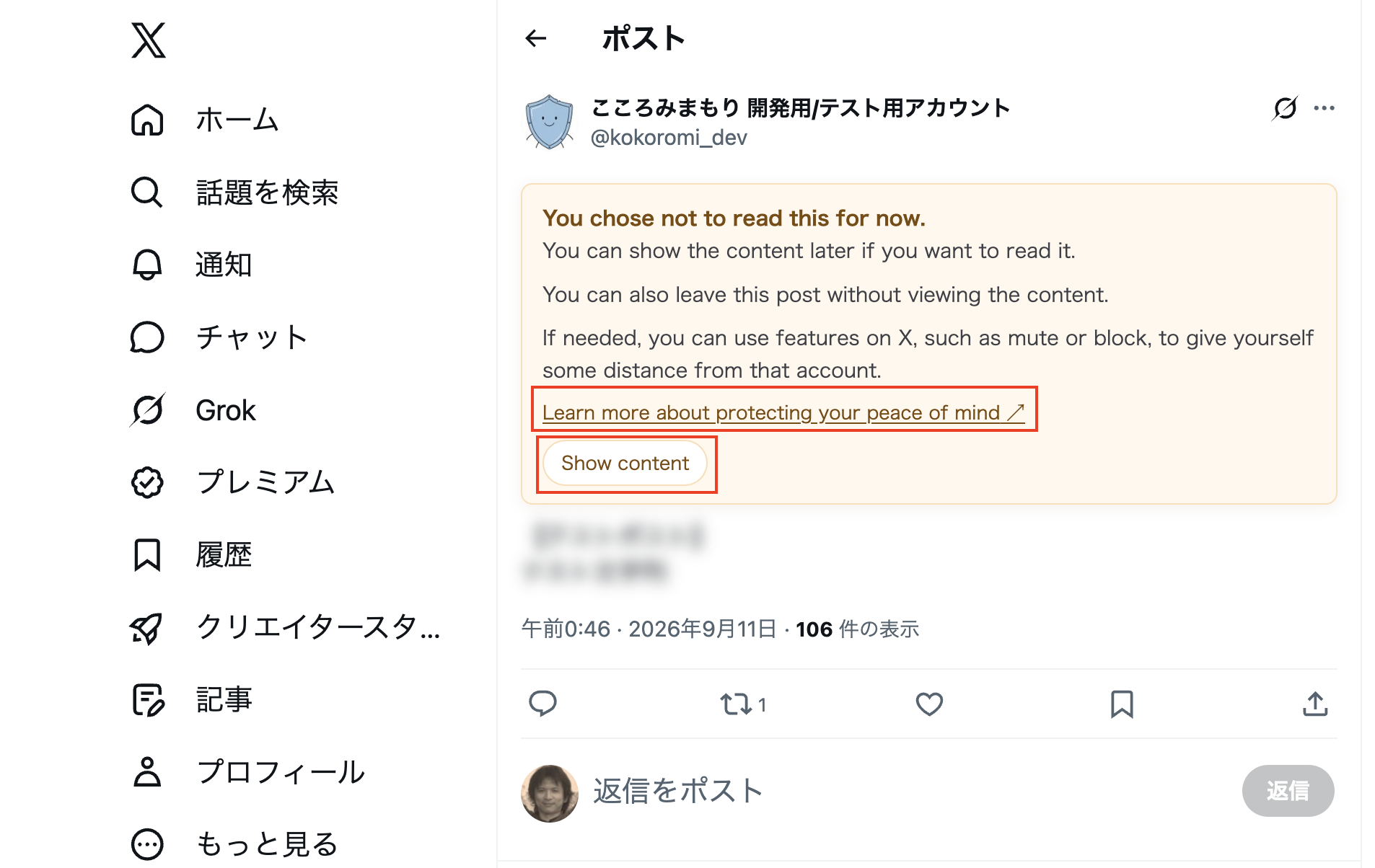 The English cushion after choosing Not now, with the post still blurred, guidance about leaving the post or using X features such as mute or block, a Learn more about protecting your peace of mind link, and Show content still available